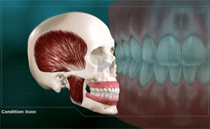 Skull and teeth diagram, showing jaw muscles and dental alignment.