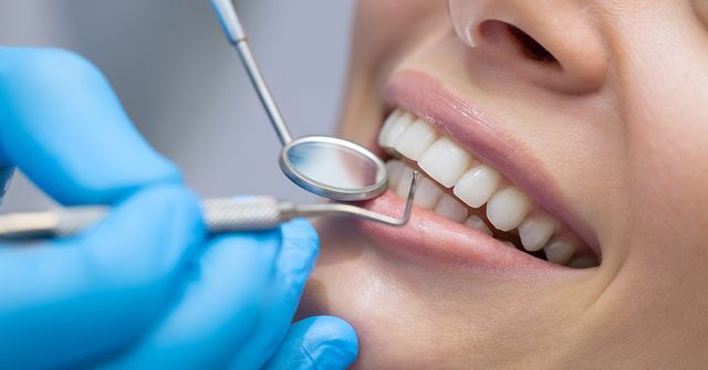 A General Dentist Answers Dental Filling Questions