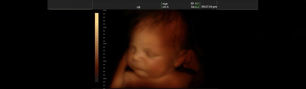 DR. GUILLERMO CAZARES URBINA - Ecografía Doppler