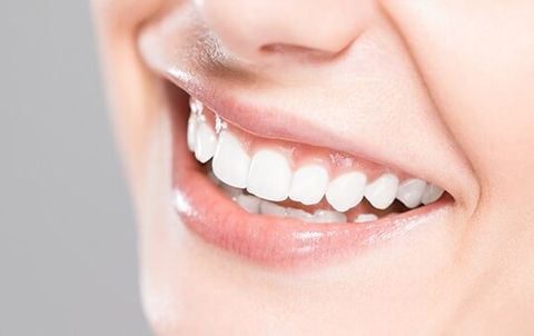 Teeth Whitening — Dental Services in Gastonia, NC