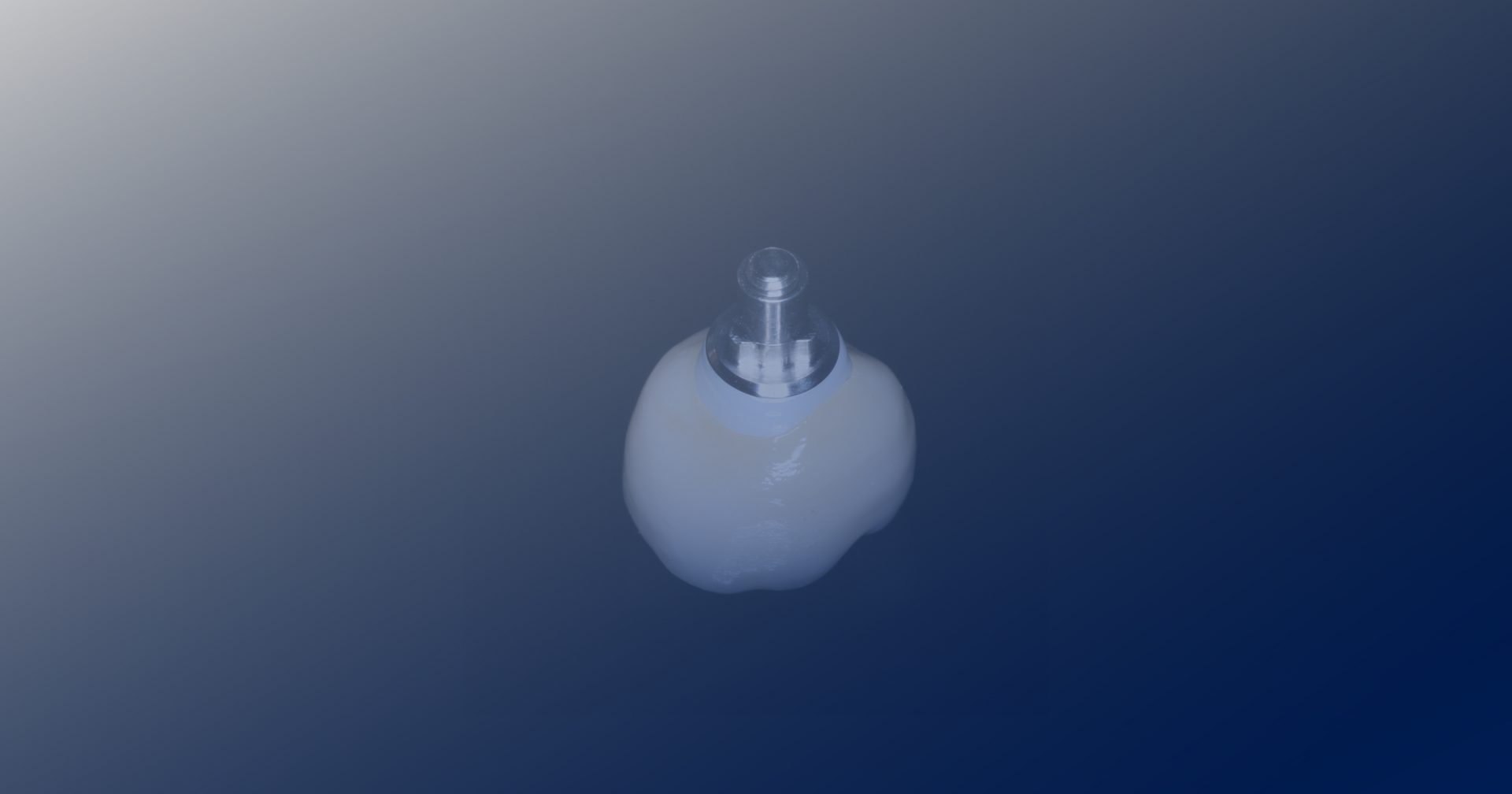 Custom Abutments with Modern Methods Dental Lab