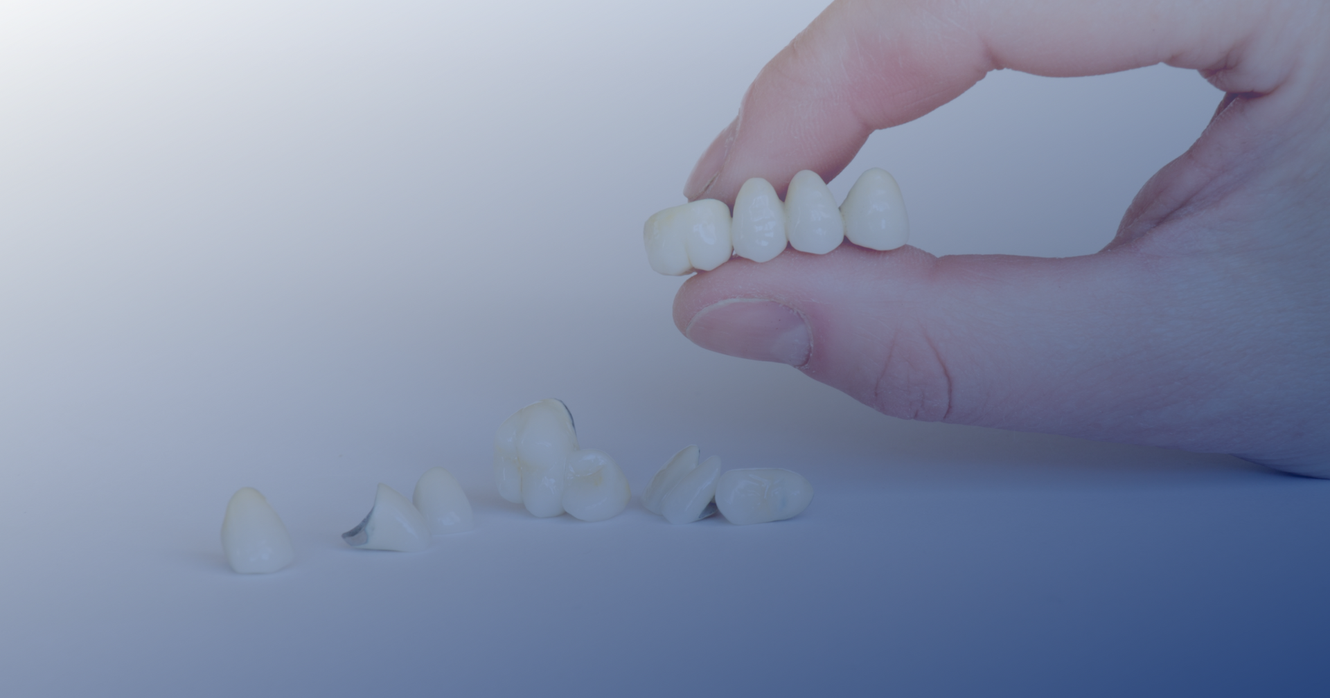 Zirconia Crowns with Modern Methods Dental Lab