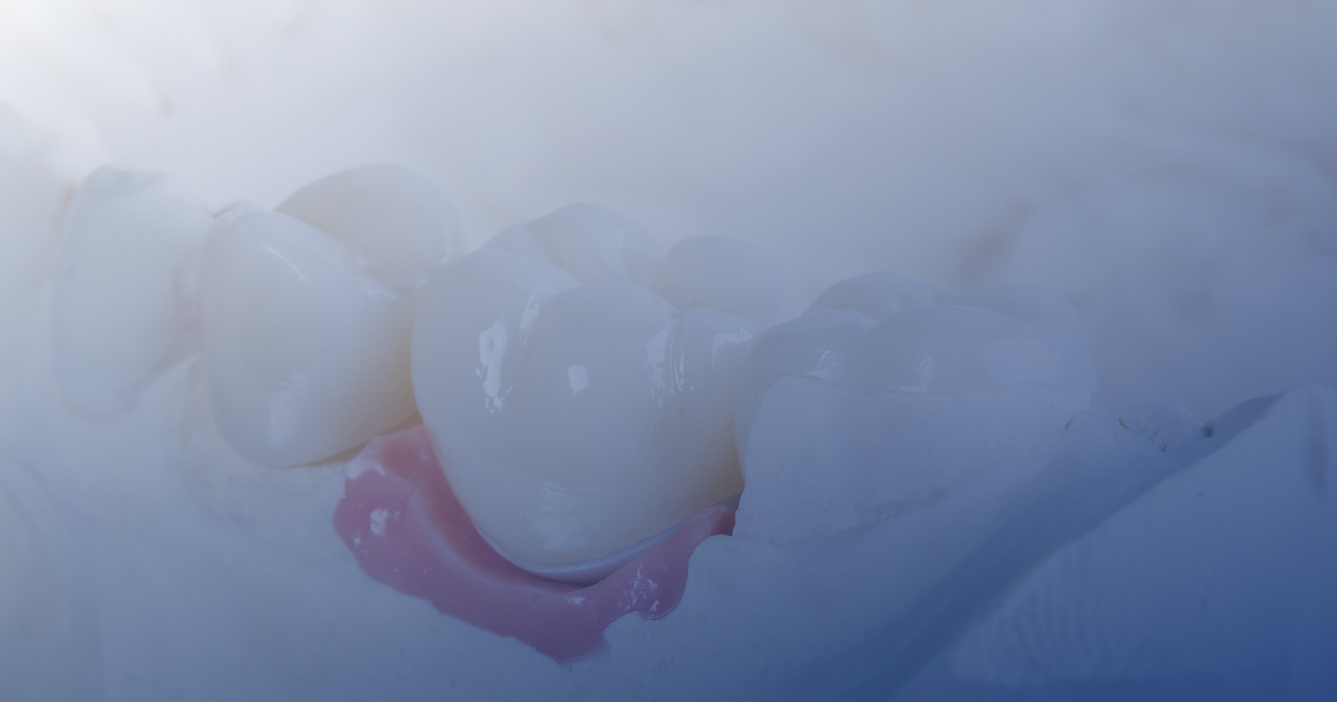 Ceramic Crowns with Modern Methods Dental Lab