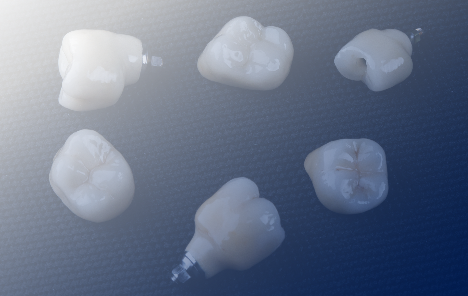 Explore the process of creating custom ceramic crowns at Modern Methods Dental Lab.