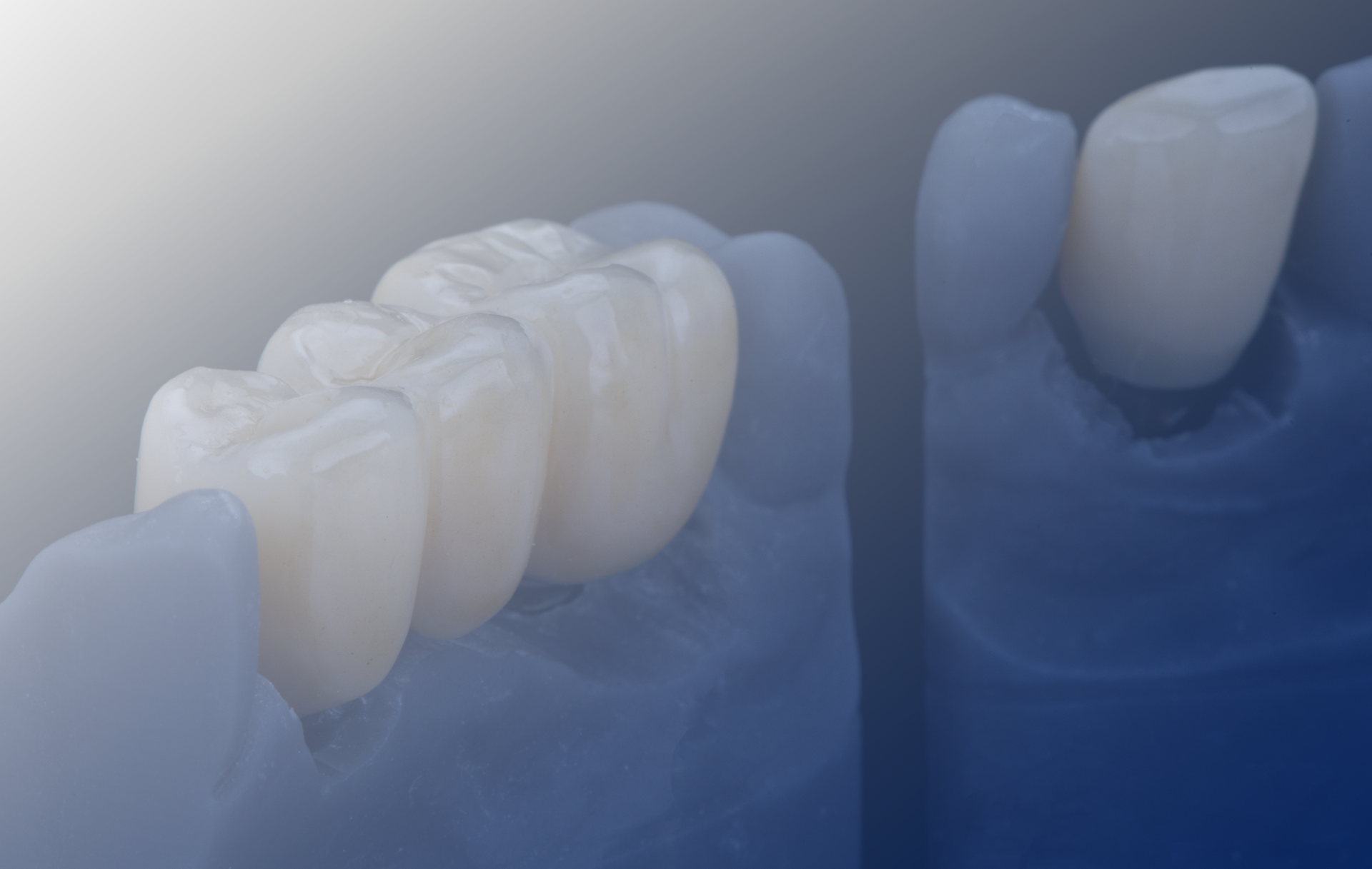 Discover the science behind Zirconia crowns at Modern Methods Dental Lab