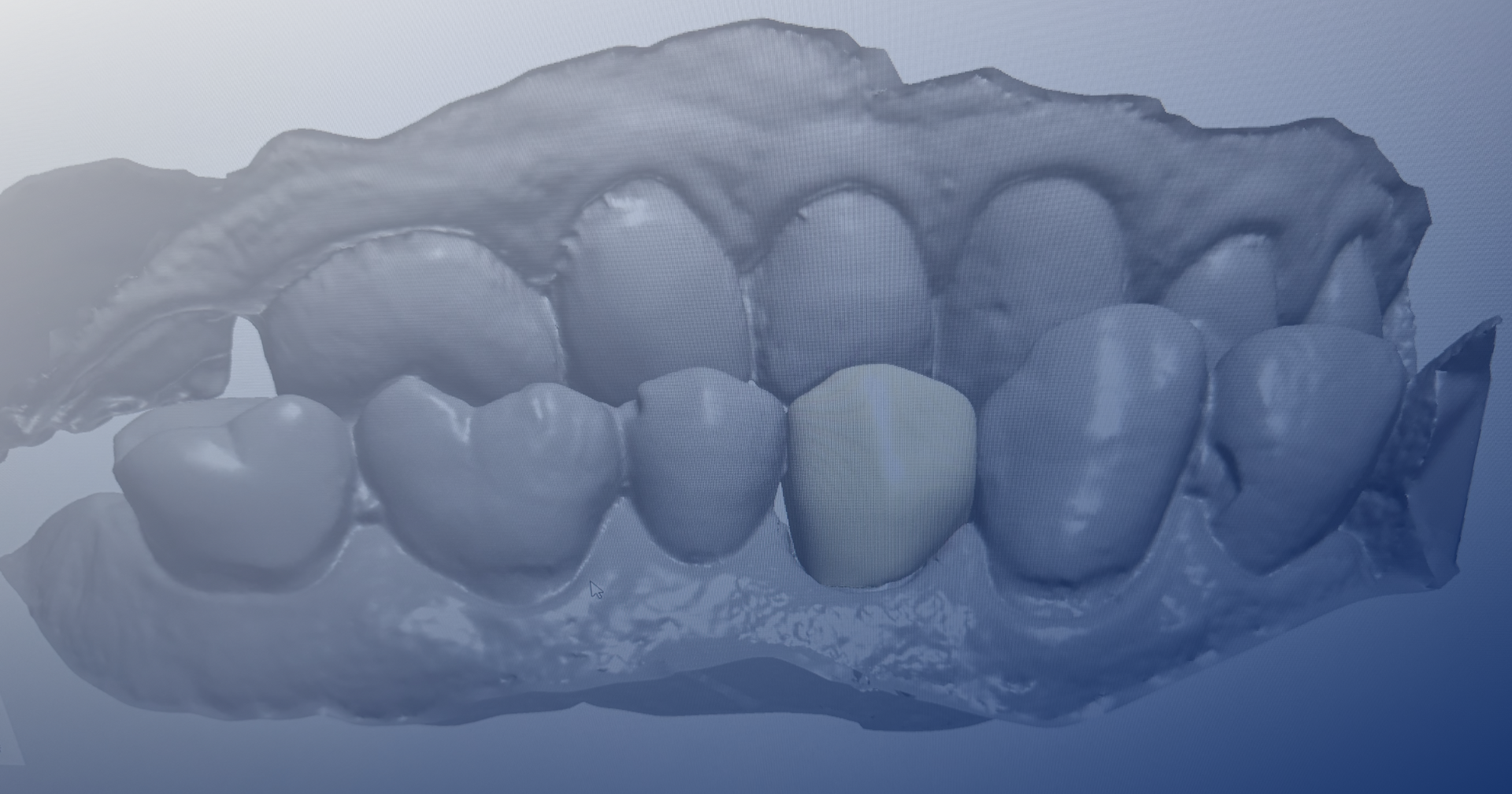 Dental Lab in Wichita, KS with Modern Methods Dental Lab