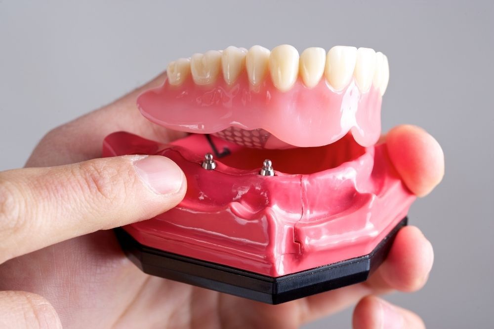 Hand holding a model of dentures attached to a pink gum base, with two small silver studs.
