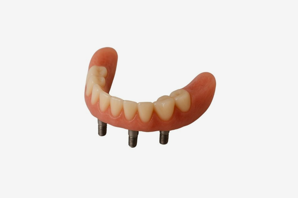Partial denture with artificial teeth, pink gums, and three metal posts.