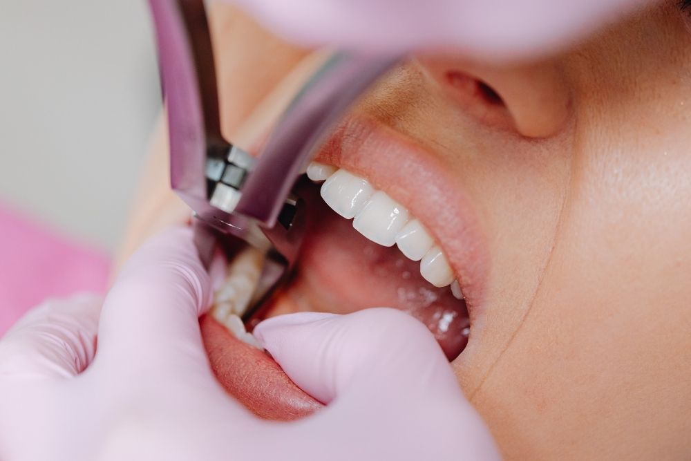 Dentist using tools on a patient's open mouth; pink gloves, dental setting.