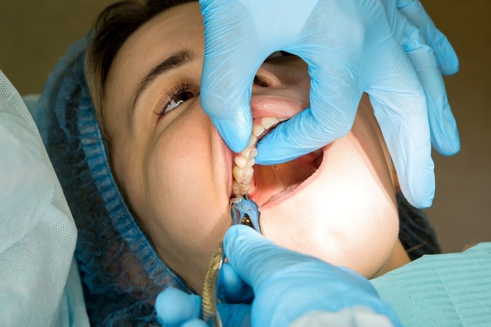 Dentist working on patient's mouth; blue gloves, instruments, dental setting.