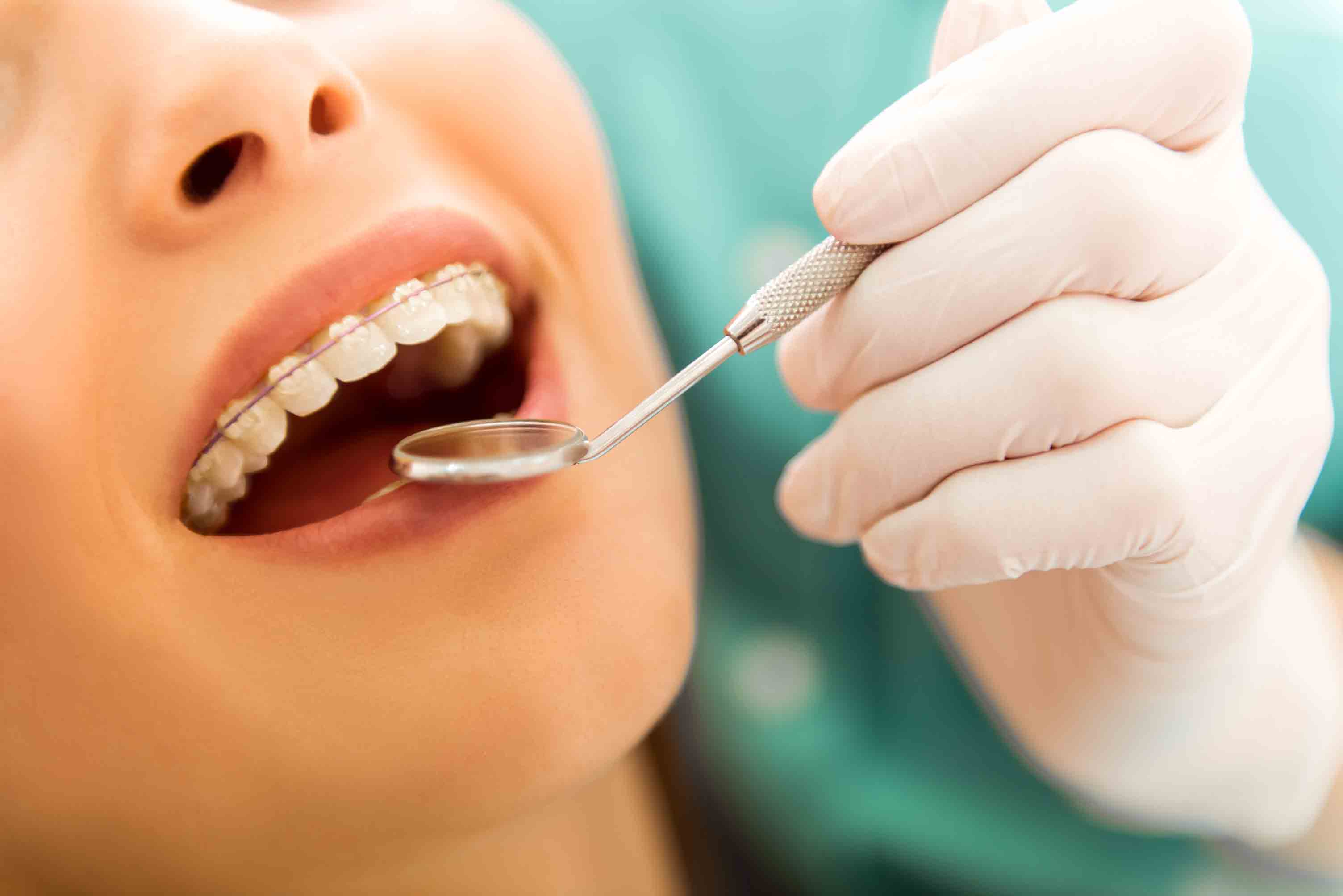 checking braces at orthodontics