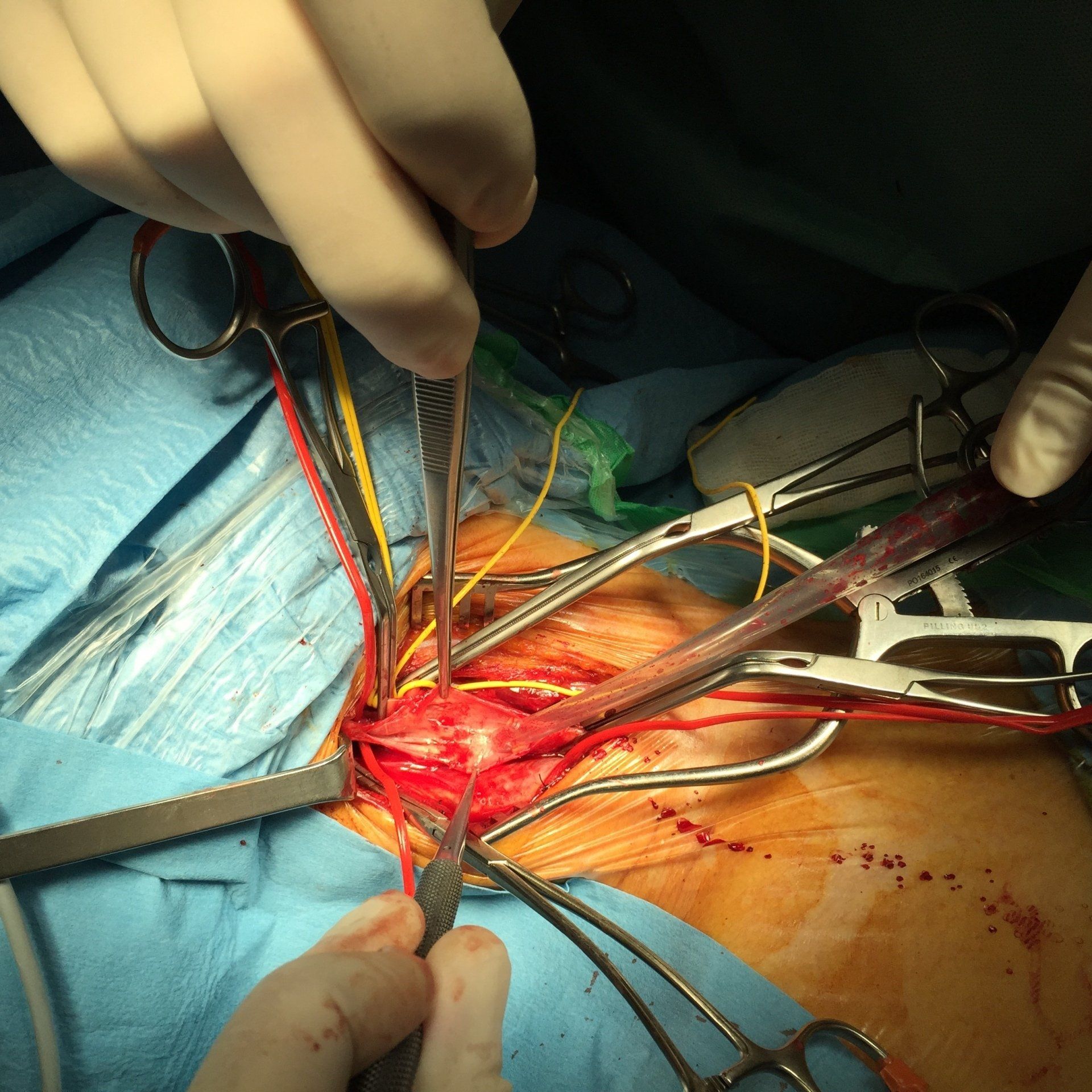 Tecniche chirurgiche