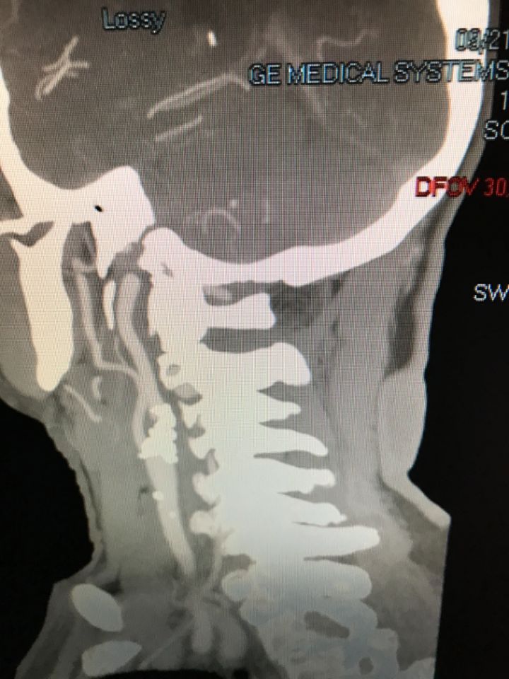 radiografia pre-intervento
