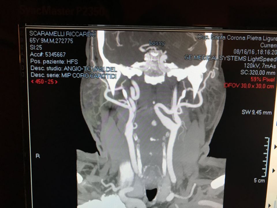 vista radiografia pre-intervento