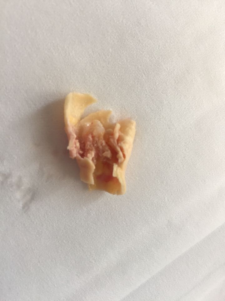 dettaglio di un intervento