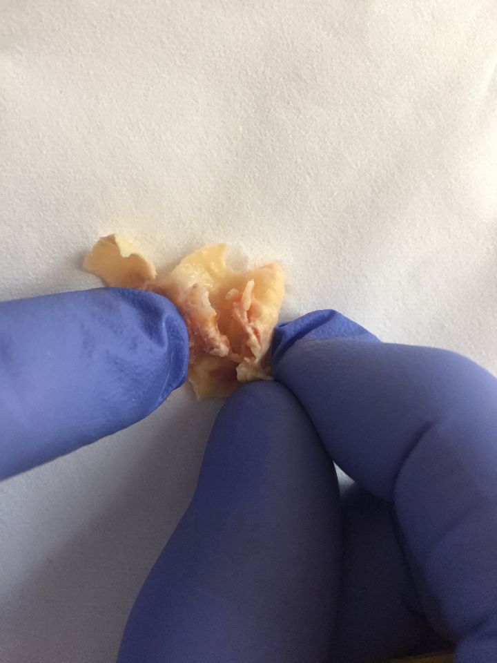 dettaglio intervento