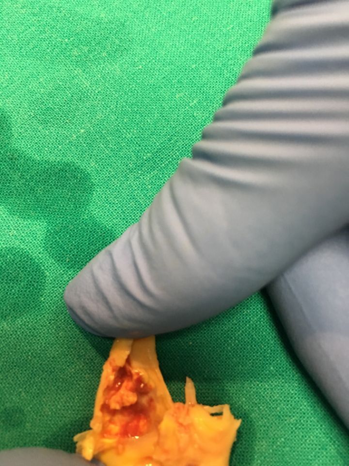 intervento in corso di esecuzione