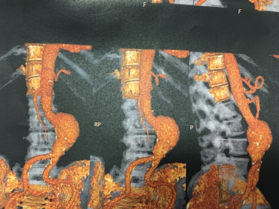 analisi esami prima di eseguire un intervento