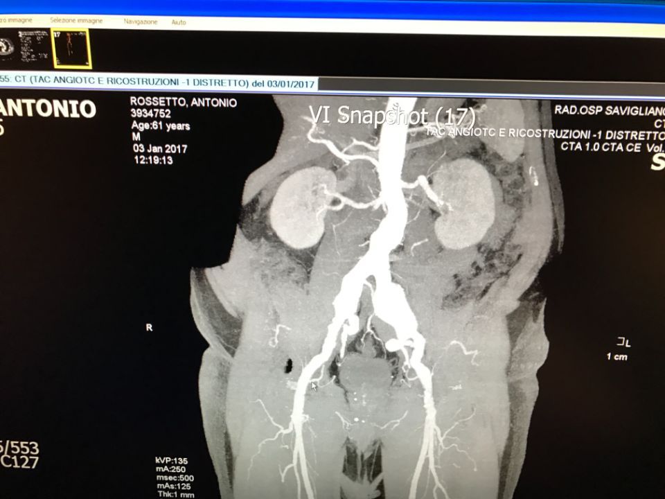 esami prima di un intervento