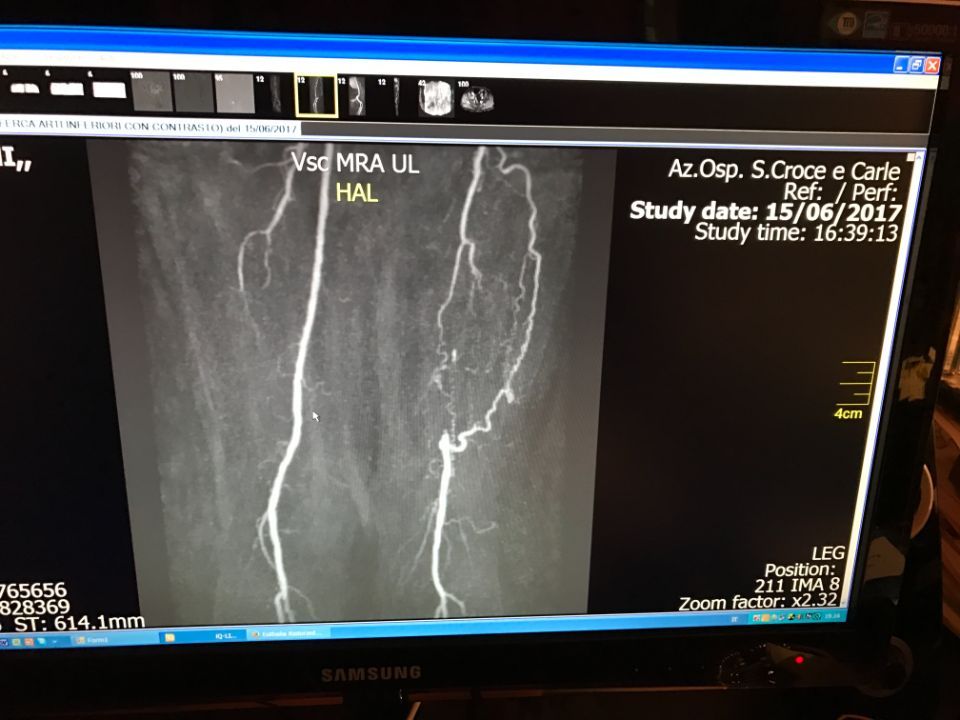 arterie prima di un intervento