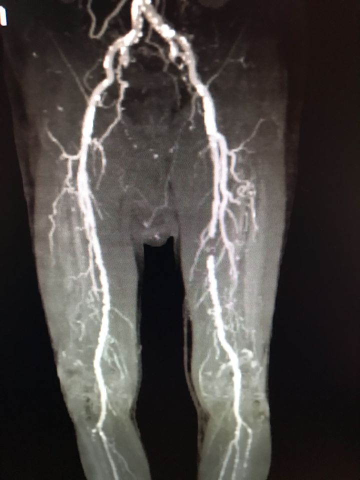 vista radiografia prima di un intervento