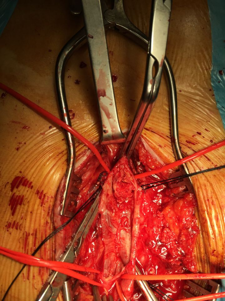 intervento eseguito dal dottore