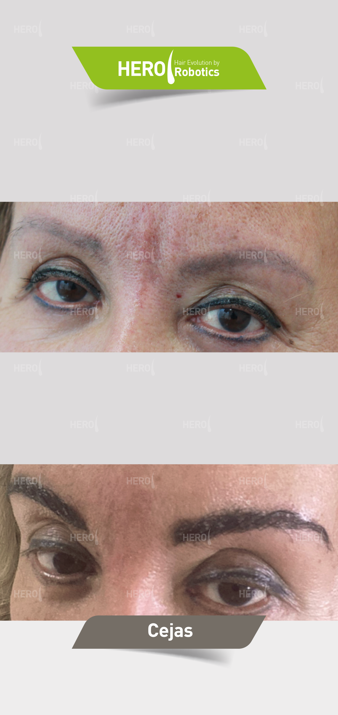 A before and after picture of a man 's hair