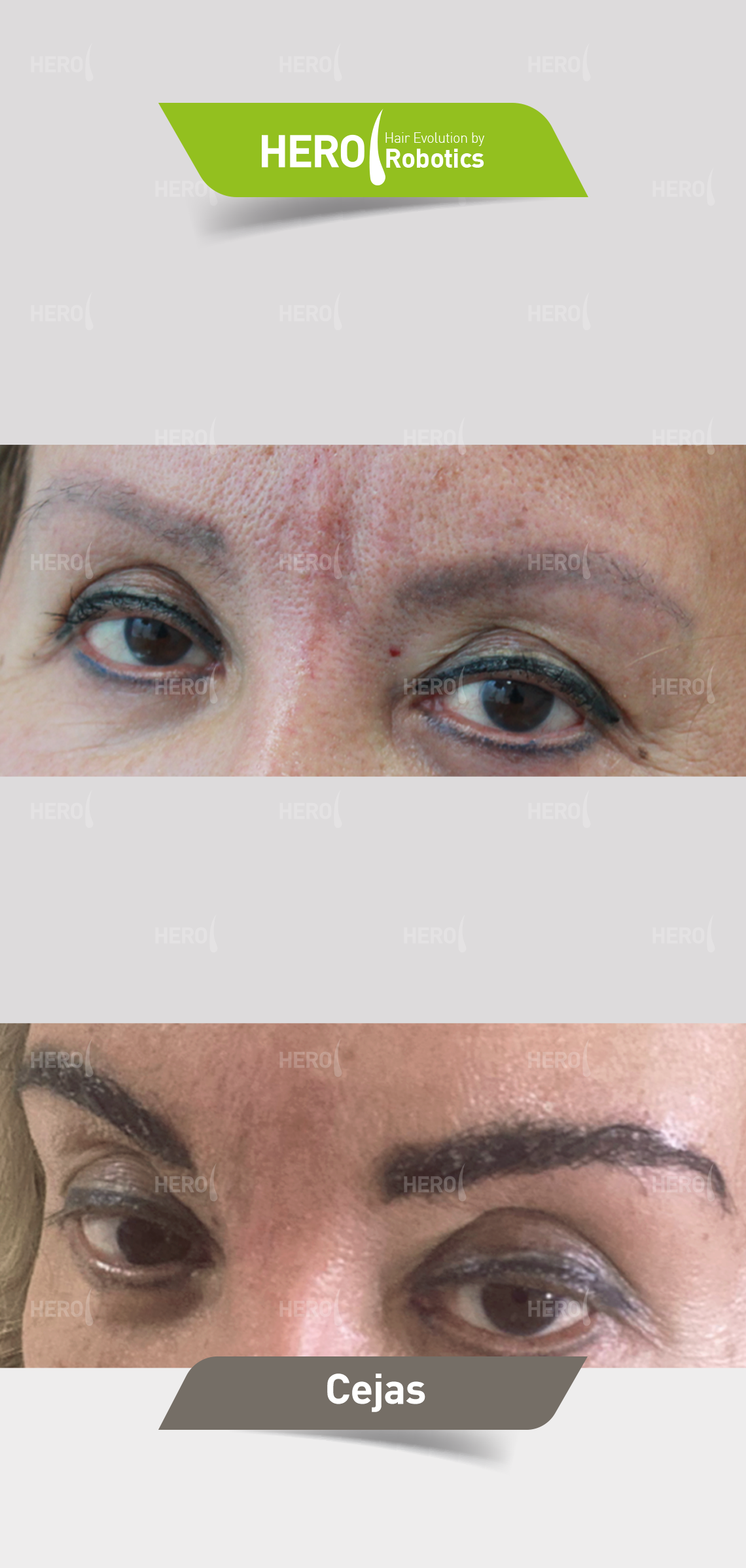 Before and after eyebrow treatment, showing fuller, darker eyebrows.