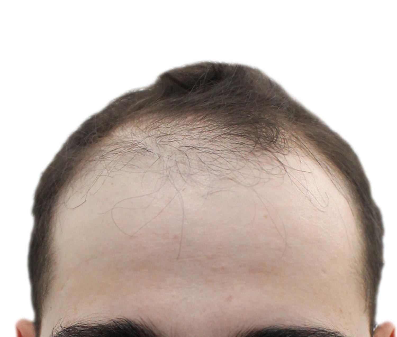 a man with a bald head is looking at the camera .