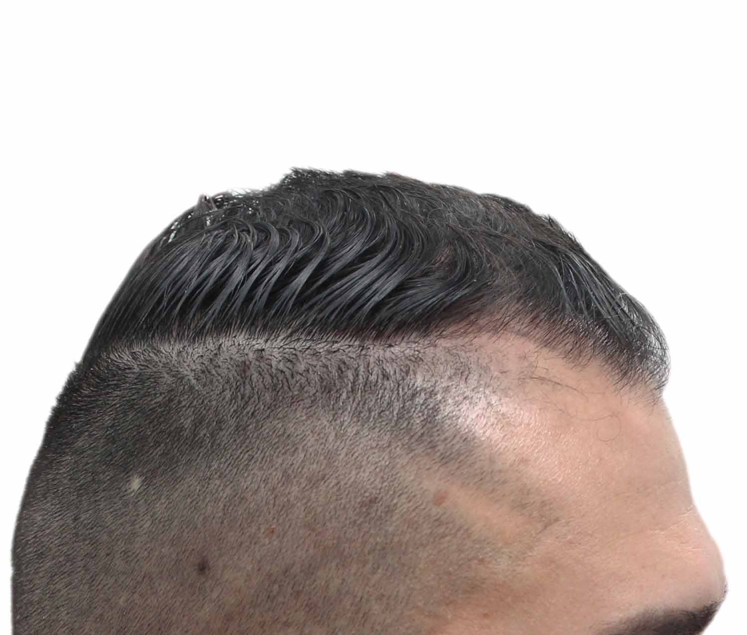 a close up of a man 's head with a shaved head