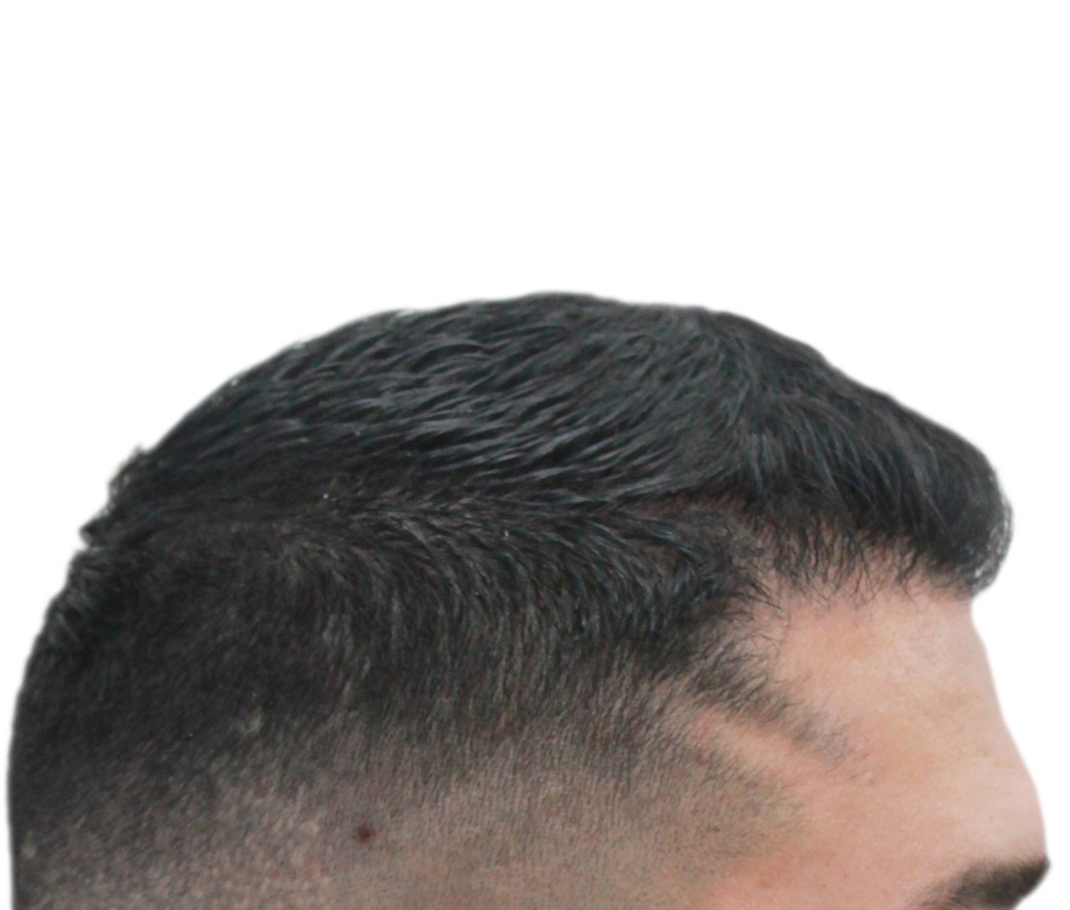 a close up of a man 's head with a shaved head .