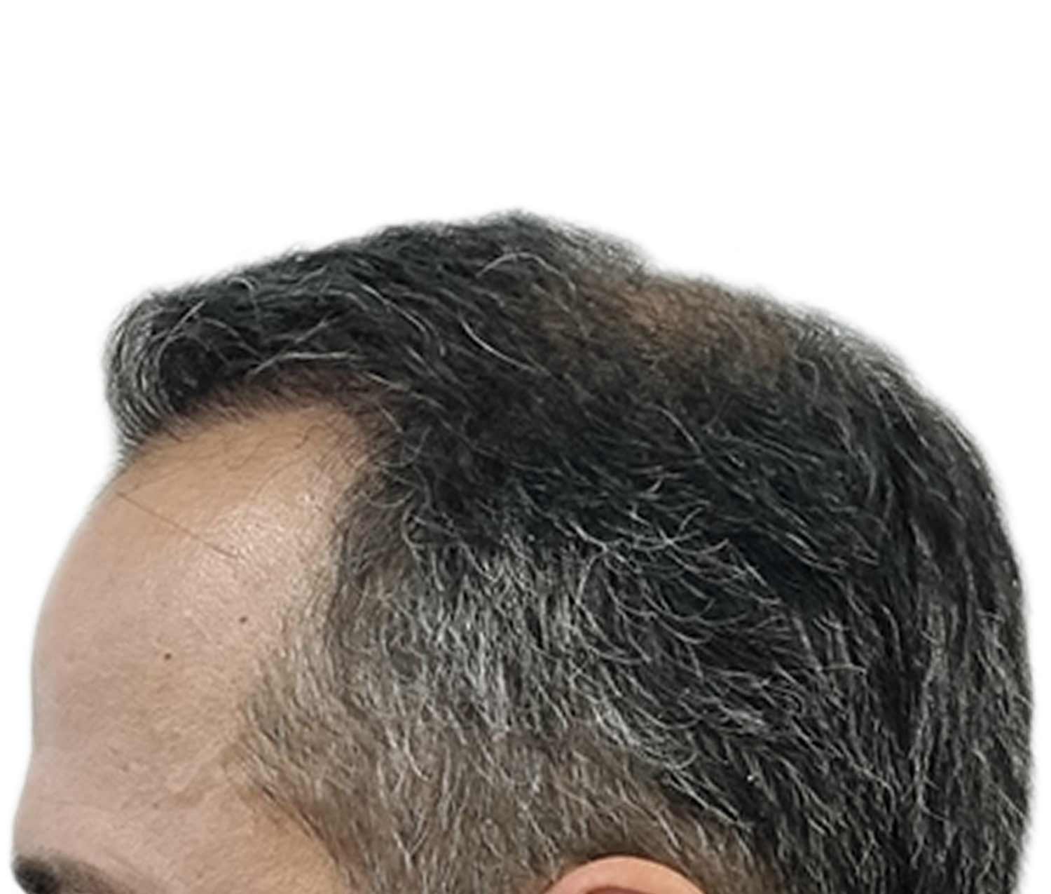 a close up of a man 's head with gray hair .