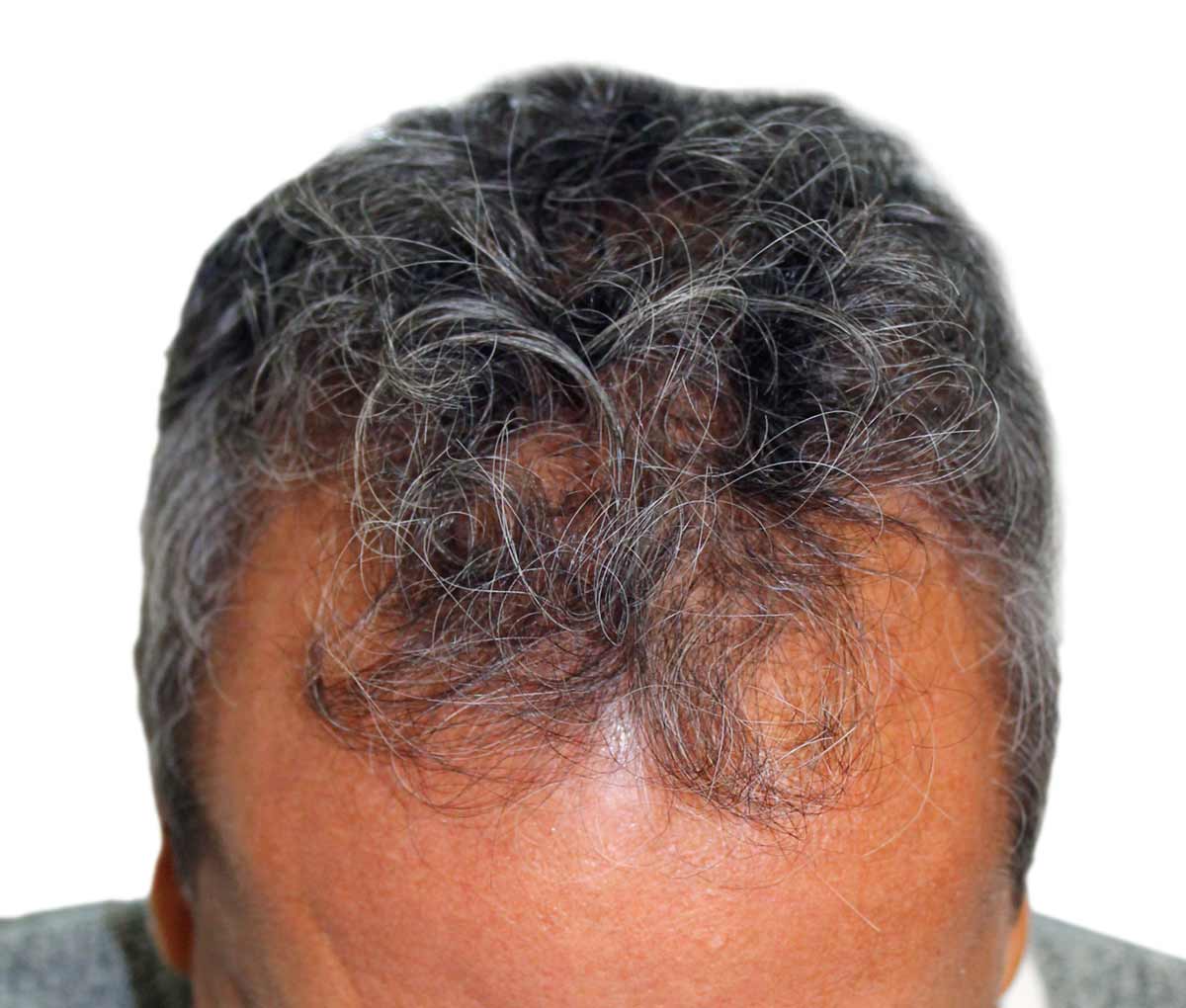 a close up of a man 's head with gray hair .