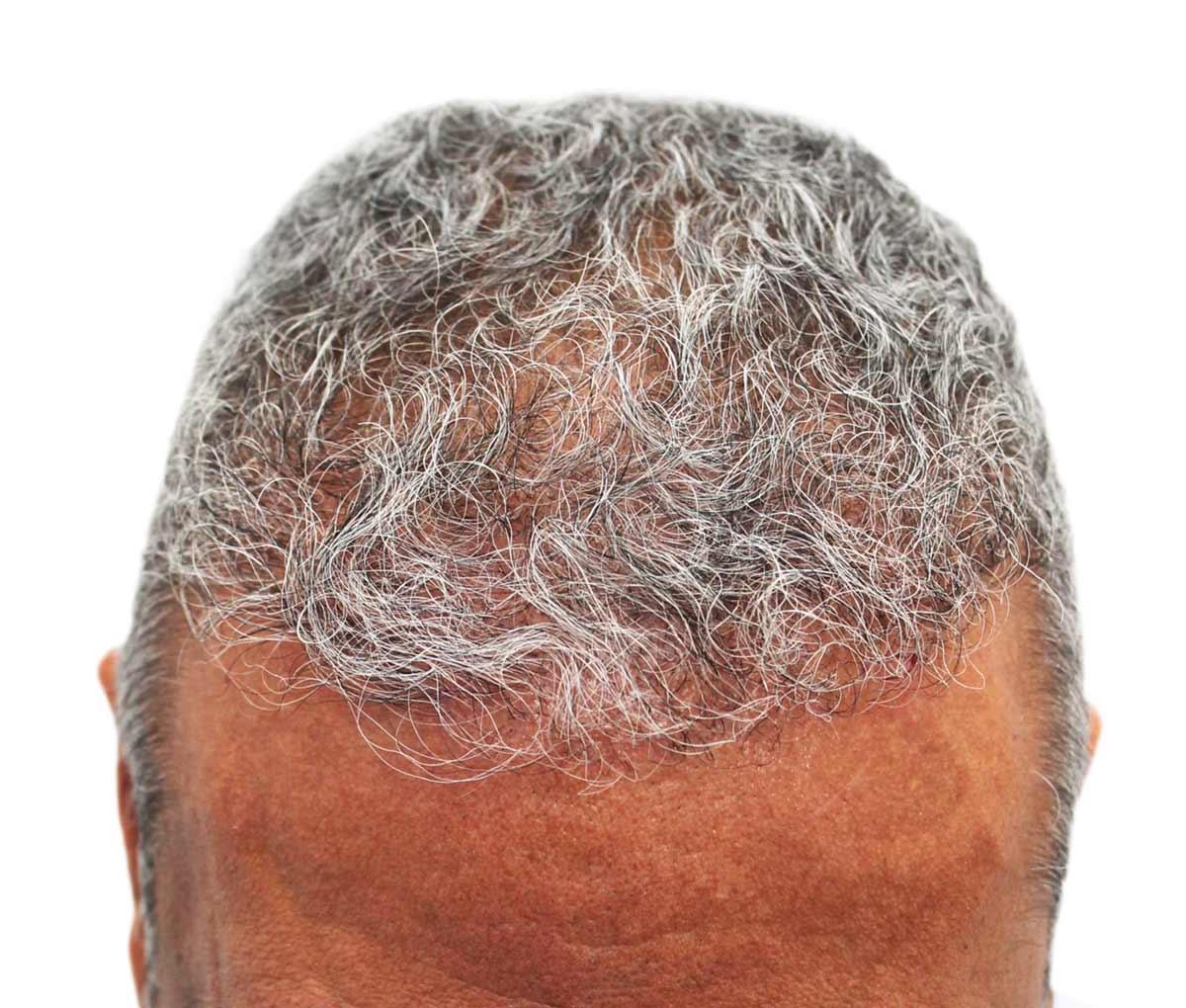 un primer plano de la cabeza de un hombre con cabello gris.