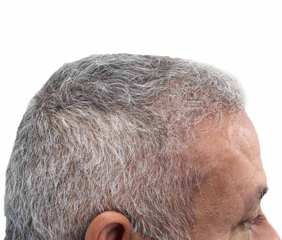 un primer plano de la cabeza de un hombre con cabello gris y barba.