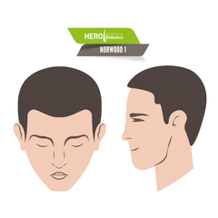 Understanding Norwood Level 1 Hair Loss in 2024