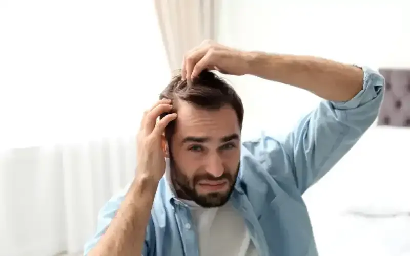 Man looking at his scalp