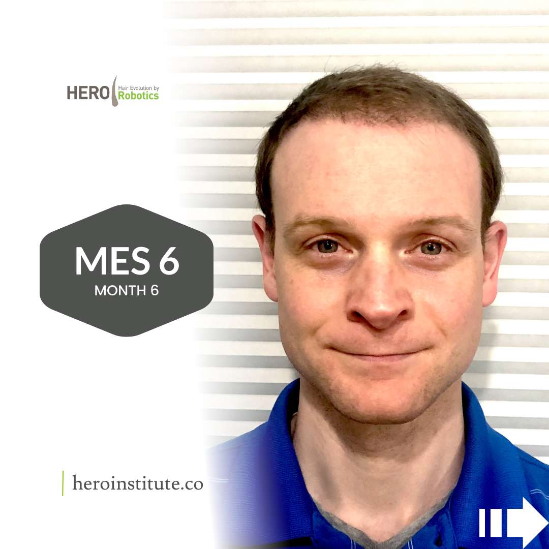 a man is wearing a blue shirt and smiling for the camera .