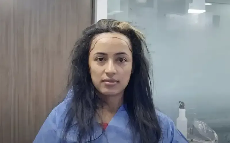 Woman Getting a Hair Restoration Procedure