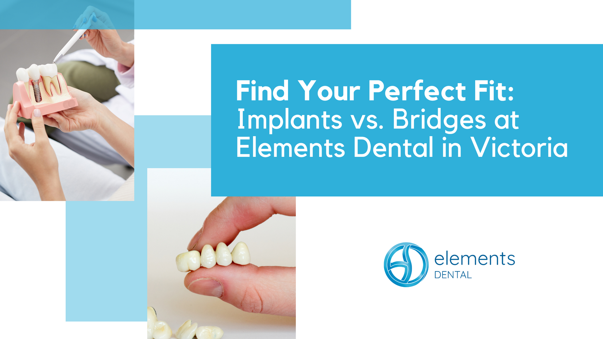 A poster that says `` find your perfect fit : implants vs. bridges at elements dental in victoria ''