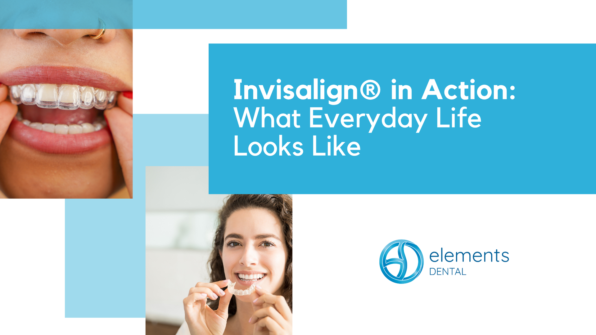 Woman smiling with Invisalign; text reads 