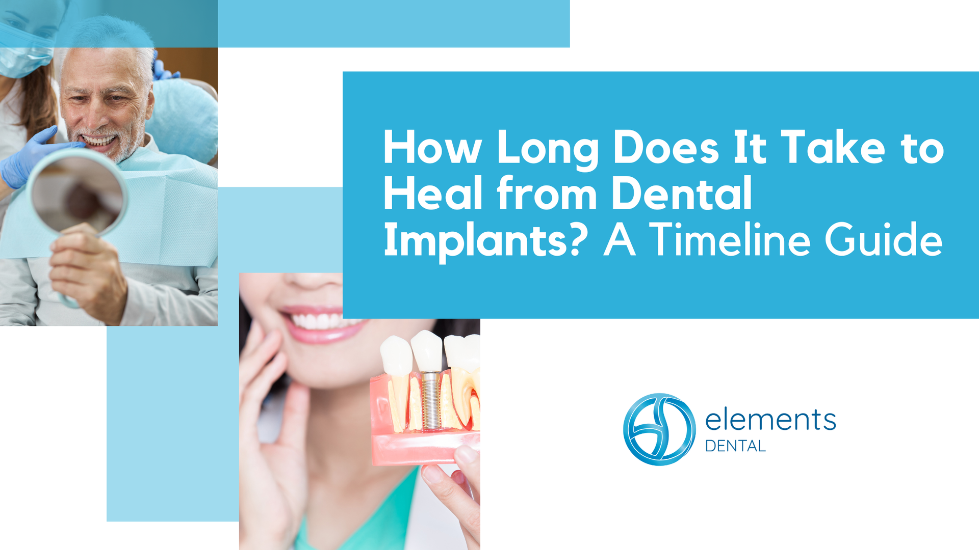 Informative graphic about dental implants, featuring a patient, a model of teeth, and the text 