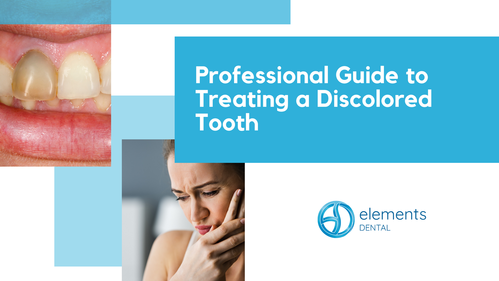 A professional guide to treating a discolored tooth