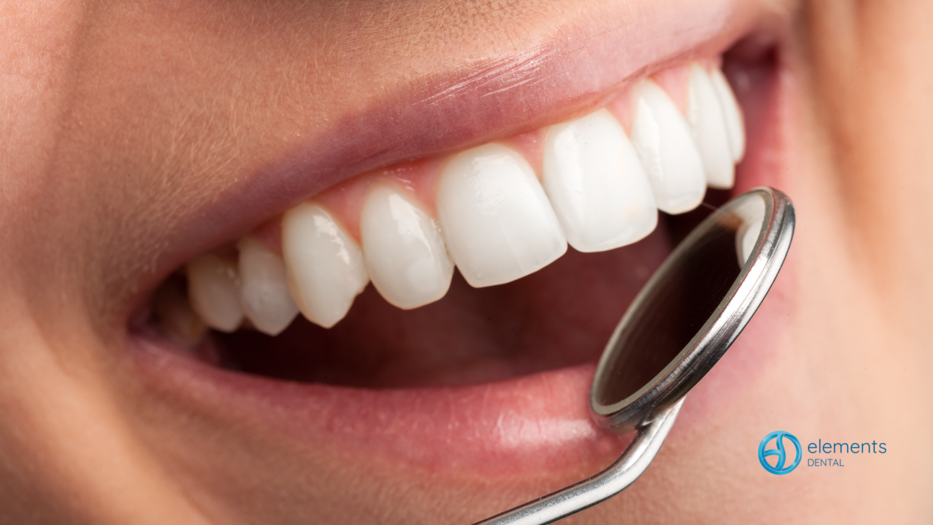 A woman is getting her teeth examined by a dentist.