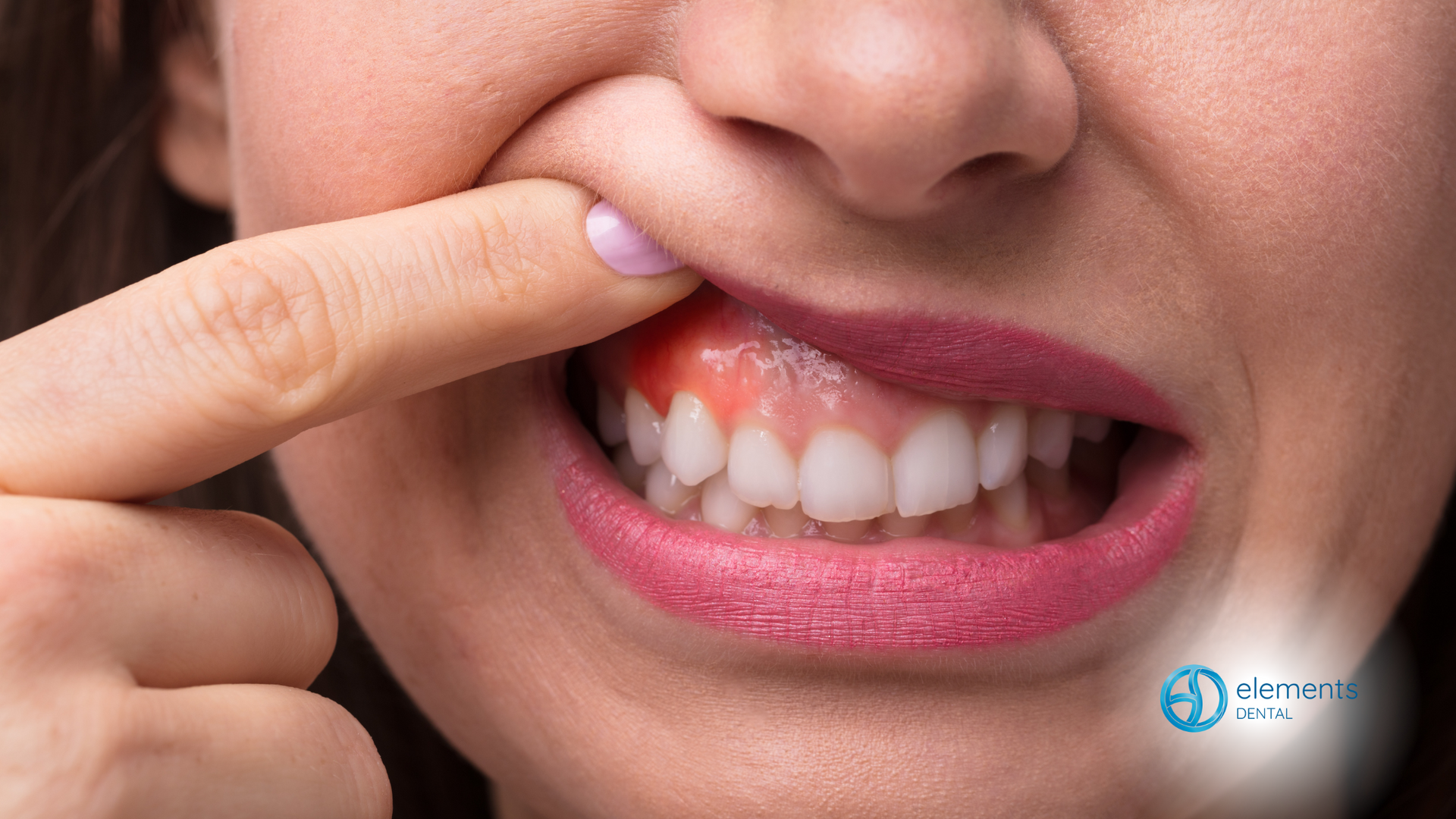 A close up of a woman 's mouth with a toothache.