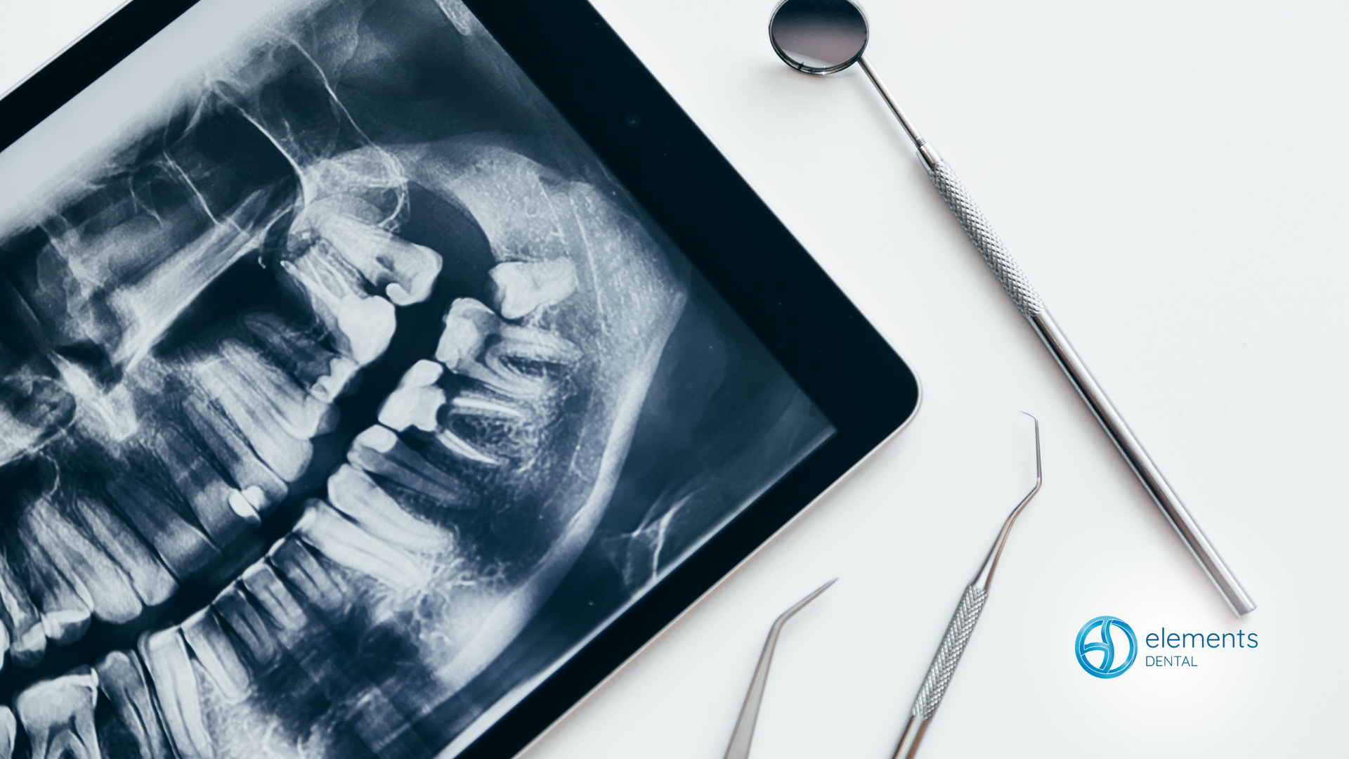 An x-ray of a person 's teeth is on a tablet next to dental instruments.