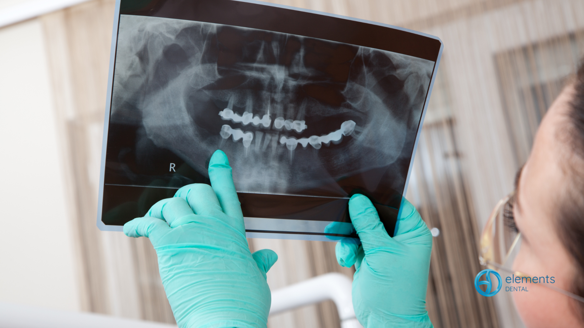 A dentist is holding an x-ray of a person 's teeth.