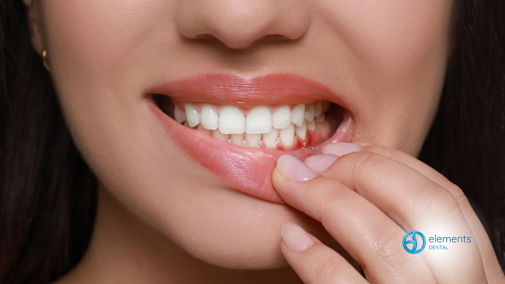 A close up of a woman 's mouth with her hand on her teeth.