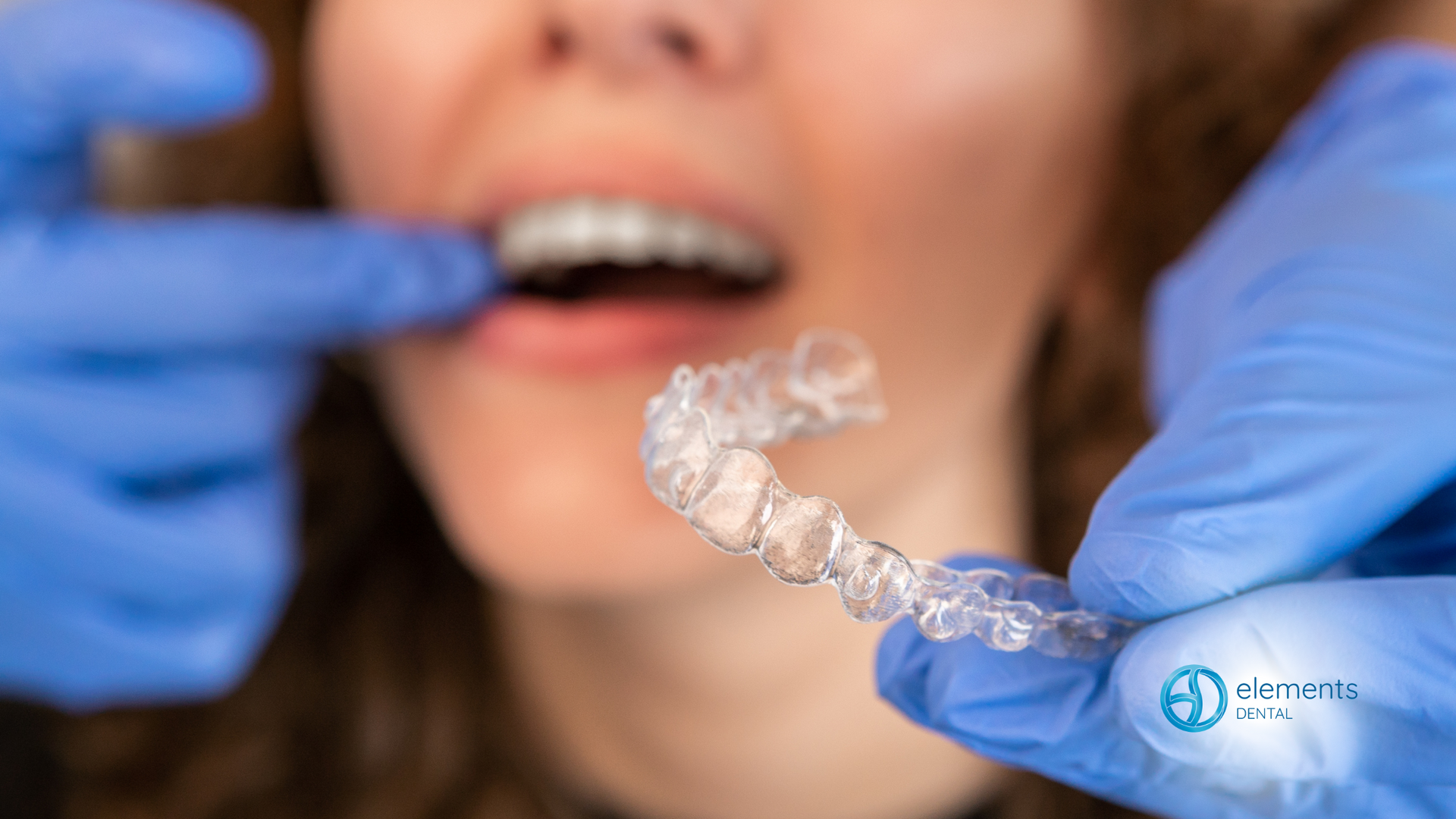 A woman is getting her teeth straightened by a dentist.