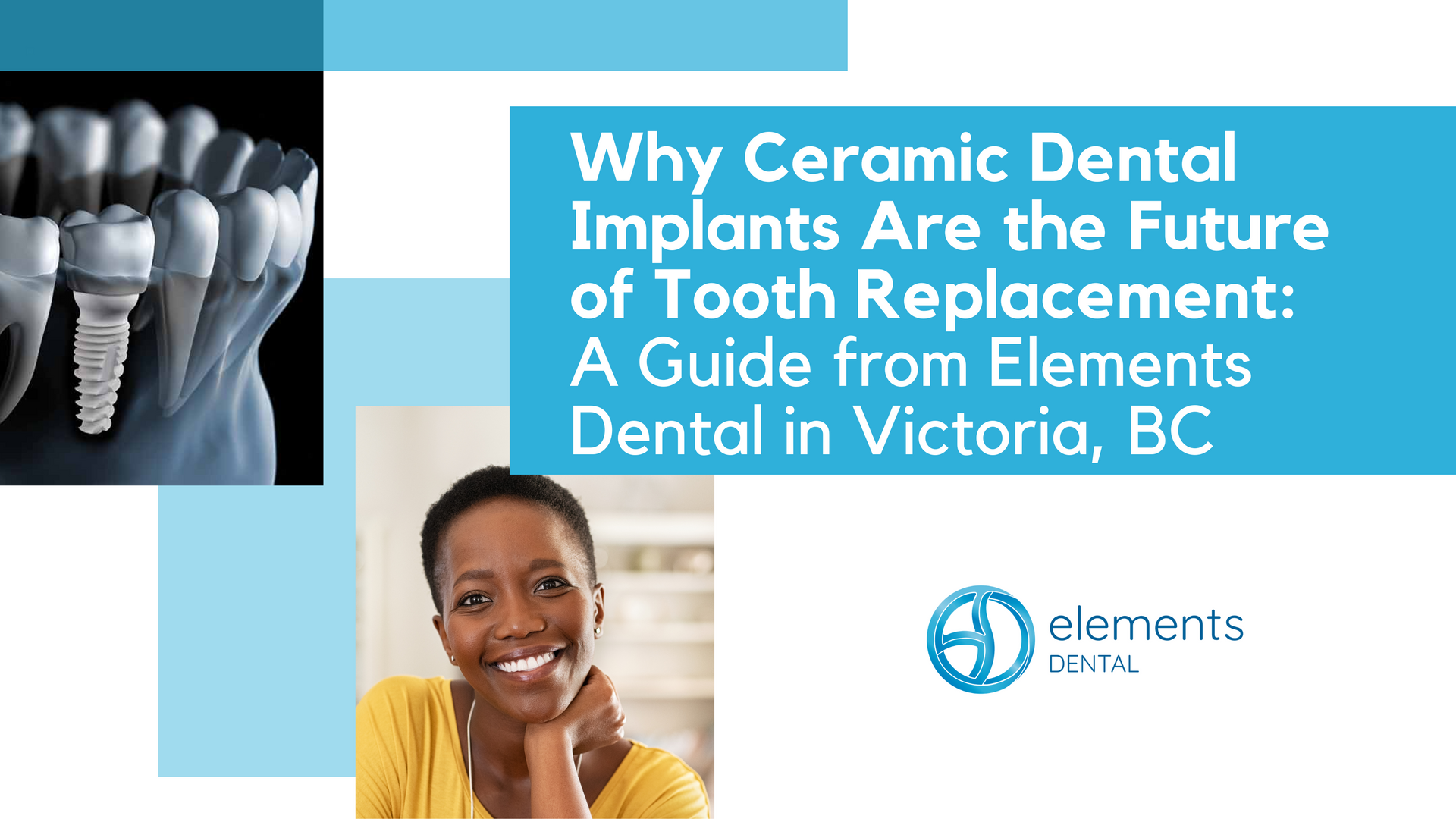 Why ceramic dental implants are the future of tooth replacement : a guide from elements dental in victoria , bc